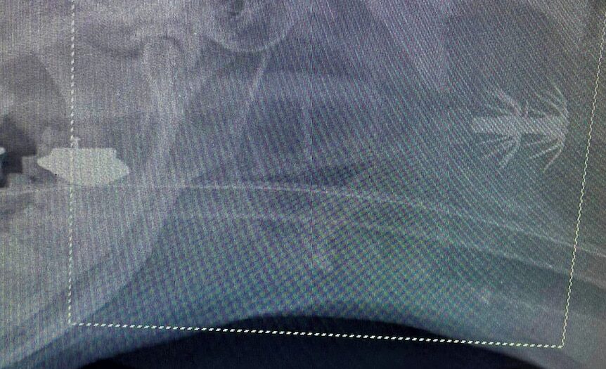 Lucky dog off the hook after vet removes multi-barbed squid jig from throat