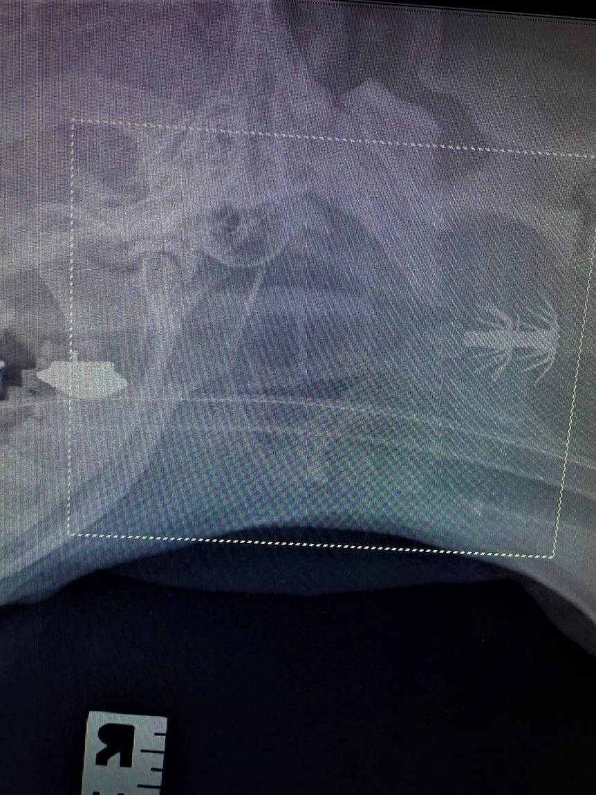 Lucky dog off the hook after vet removes multi-barbed squid jig from throat